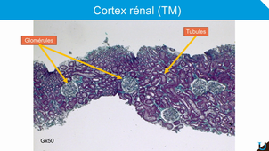 Introduction à la nephropathologie