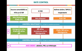 FIbrillation atriale - Rythme - A Lafargue 2021