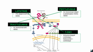 Cancer du sein - Traitement - Quoi de neuf 2021