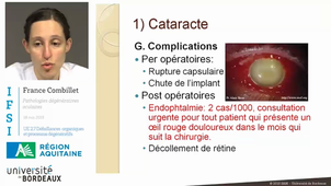 UE 2.7 - Pathologies degeneratives oculaires