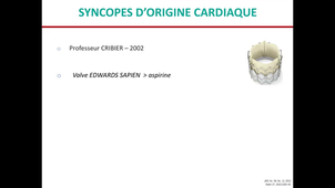 Syncope prise en charge