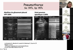 Sémiologie de l'échographie pulmonaire et diaphragmatique B Riu Poulenc