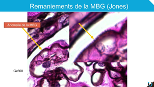 Introduction à la néphropathologie - Bertrand Chauveau